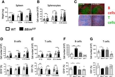 Impaired B Cell Apoptosis Results in Autoimmunity That Is Alleviated by Ablation of Btk